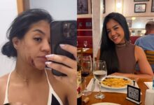 Pelas redes sociais, Raquel denunciou ter sido agredida pelo então companheiro (Imagens: Captura de tela/Instagram)
