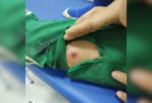 Vítima foi atingida na perna enquanto voltada para casa. (Foto: Reprodução)