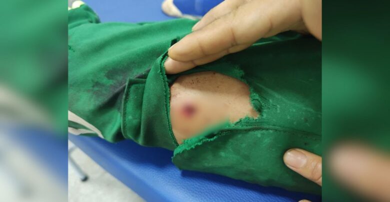 Vítima foi atingida na perna enquanto voltada para casa. (Foto: Reprodução)